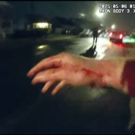 After he was allegedly stabbed, the police officer's hand appeared bloody in his body cam footage.